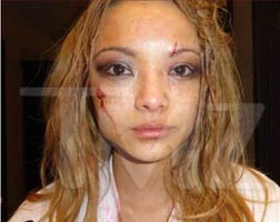 <b>Tila Takes A Beating...</b>